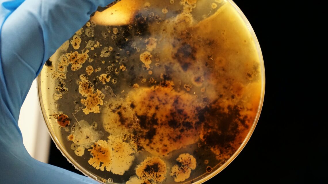 Agar plate with microorganisms